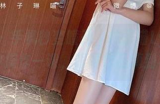 微密圈 – 手机秒变瞳孔，林子喵Lynne在线带你操作一课，眼镜作品嗨到不行！